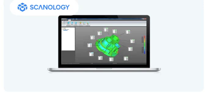 Interface du logiciel SCANOLOGY ScanViewer sur un ordinateur portable